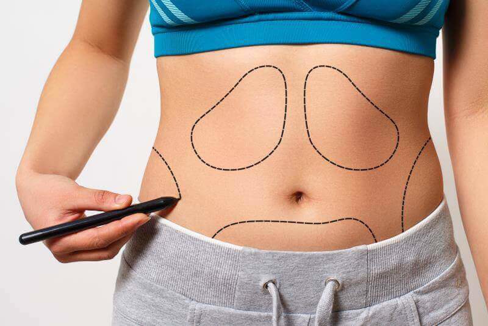 Liposuction Nedir? Sağlık Açısından Yararlı mı Yoksa Zararlı mı?